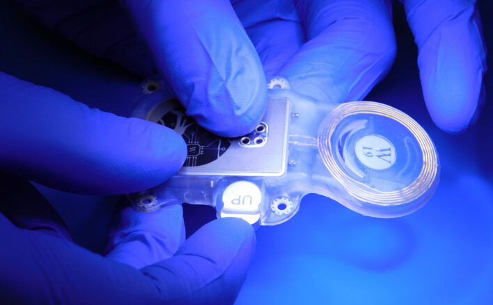 Brain-computer interfaces: ABILITY Neurotech moves closer to clinical reality